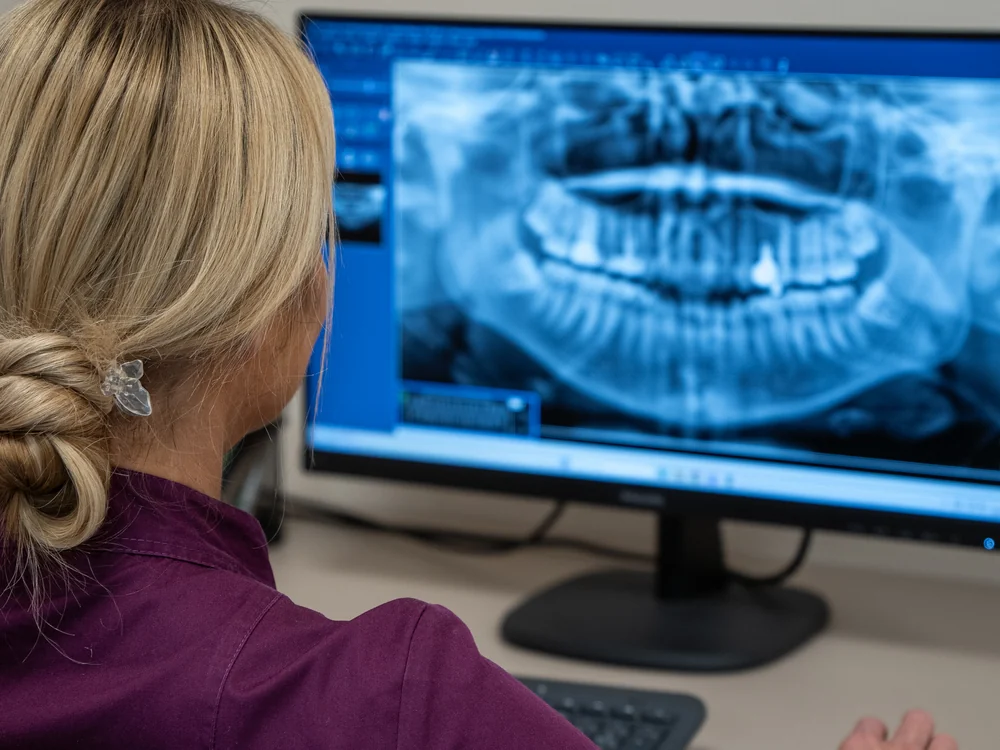 arcüregemelés cbct felvétel dnp dental budapest 11 kerület
